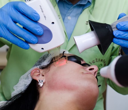 Czym jest i jak działa ablacyjny laser frakcyjny?